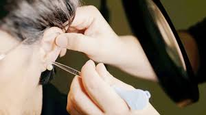 Gentle & Professional Ear Wax Removal in London – No More Blocked Ears!